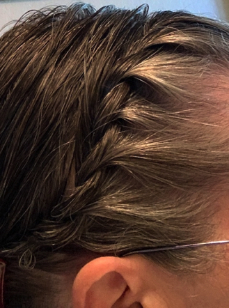 Feb 10 - Woo Hoo! Barely long enough to braid, but getting there! Feb 10 - Woo Hoo! Barely long enough to braid, but getting there!
